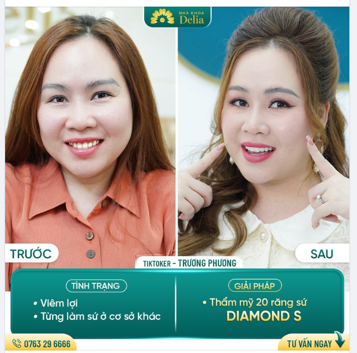 Nụ cười mới rạng rỡ - Điểm tựa giúp Tiktoker Trương Phương thành công trong sự nghiệp