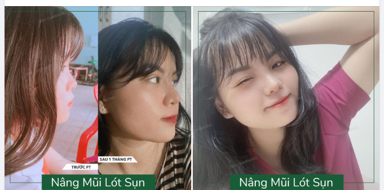 Nếu nói vẻ ngoài chỉ ảnh hưởng đến cách người ta nhìn mình thôi thì em chưa chịu đâu, vì nó còn ảnh hưởng cả cách tự em nhìn mình nữa.