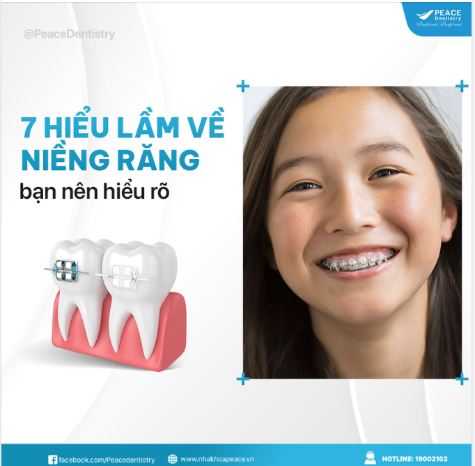 7 HIỂU LẦM VỀ NIỀNG RĂNG MÀ BẠN NÊN HIỂU RÕ