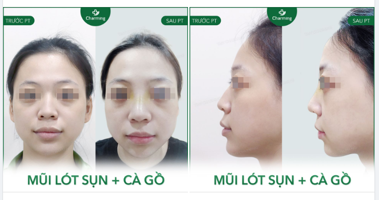 Đường thẳng luôn luôn là con đường được xem là lý tưởng nhất vì nó gợi chúng ta đến sự suôn sẻ vốn có của nó trên mọi vật thể.