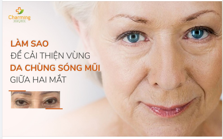 DA CHÙNG VÙNG SÓNG MŨI GIỮA HAI MẮT - MUỐN KHẮC PHỤC PHẢI LÀM GÌ?