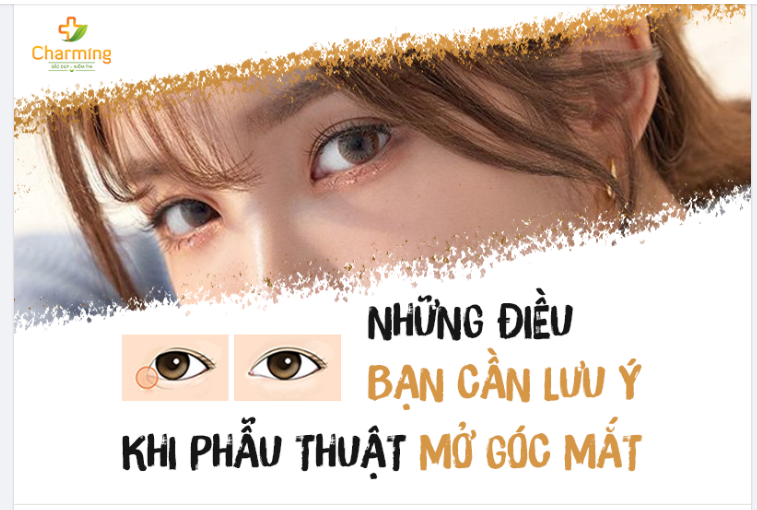 TRƯỚC KHI MỞ GÓC MẮT, BẠN CẦN BIẾT NHỮNG ĐIỀU SAU