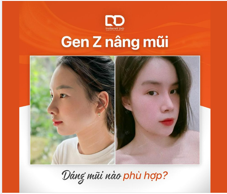 DÁNG MŨI NÀO THẬT SỰ PHÙ HỢP VỚI GEN Z?