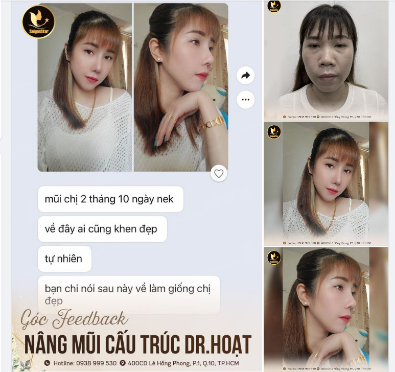 FEEDBACK MŨI CẤU TRÚC DR. HOẠT 2 THÁNG