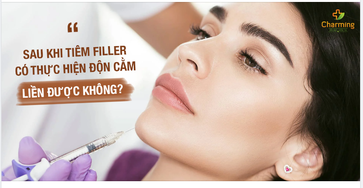 SAU KHI TIÊM FILLER CÓ THỰC HIỆN ĐỘN CẰM LIỀN ĐƯỢC KHÔNG?