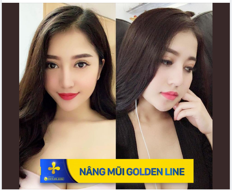 Chị em quan niệm thế nào về một chiếc mũi đẹp?