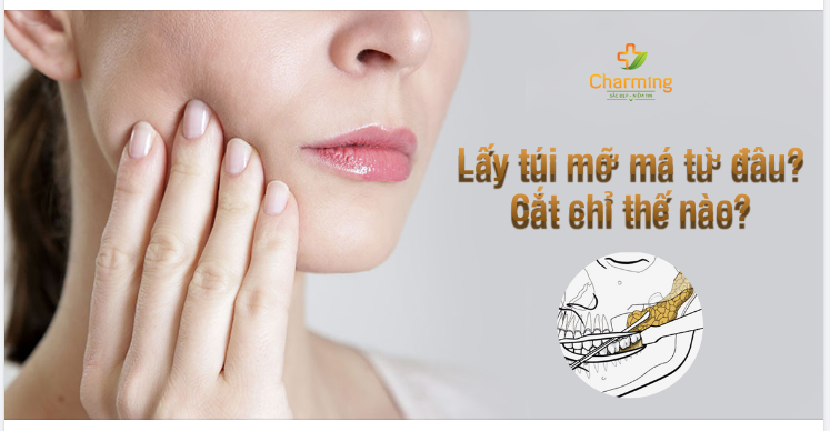 BAO LÂU THÌ CẮT CHỈ SAU KHI PHẪU THUẬT LẤY TÚI MỠ MÁ?
