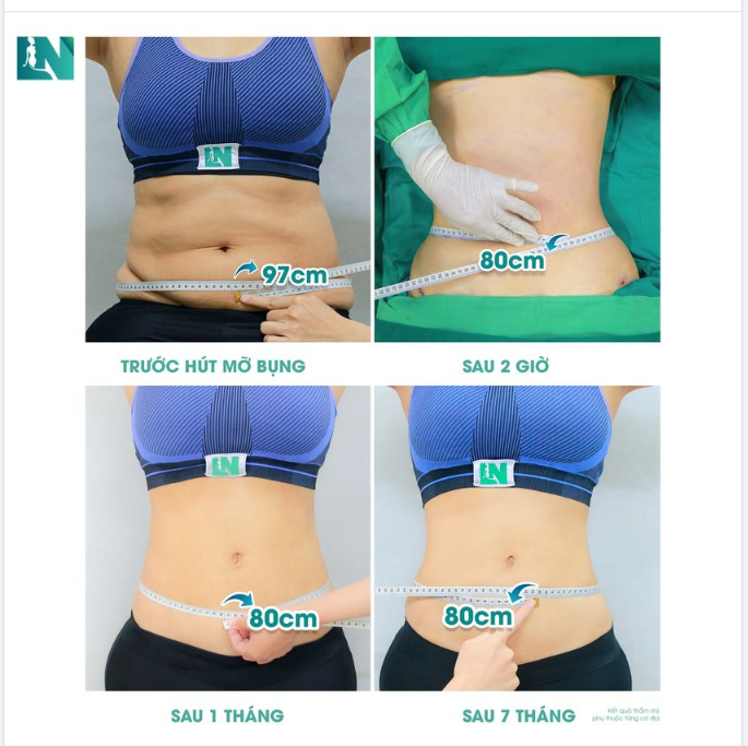 EM THAY ĐỔI THẾ NÀO SAU 7 THÁNG 