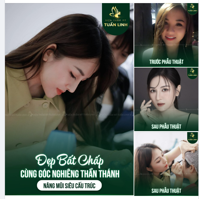 Chỉ cần một chiếc mũi cao cho nàng tỏa sáng