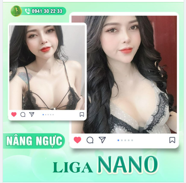V1 HOÀN HẢO THU HÚT MỌI ÁNH NHÌN