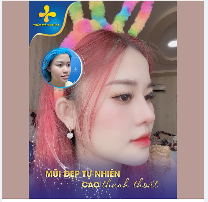 CHIẾC MŨI ĐƯỢC XEM LÀ CHÌA KHÓA VẺ ĐẸP GƯƠNG MẶT