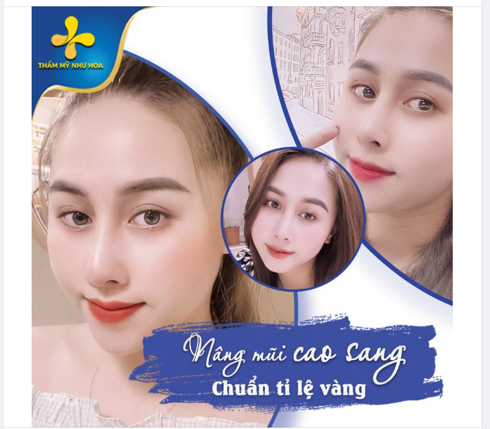 NGŨ QUAN THÊM HÀI HÒA - NHAN SẮC THÊM RẠNG RỠ NHỜ DÁNG MŨI GOLDEN LINE