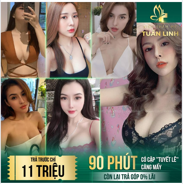 CHỈ VỚI 11TR TRẢ TRƯỚC - CÓ NGAY CẶP TUYẾT LÊ CĂNG MẨY CHỈ SAU 90 PHÚT!!
