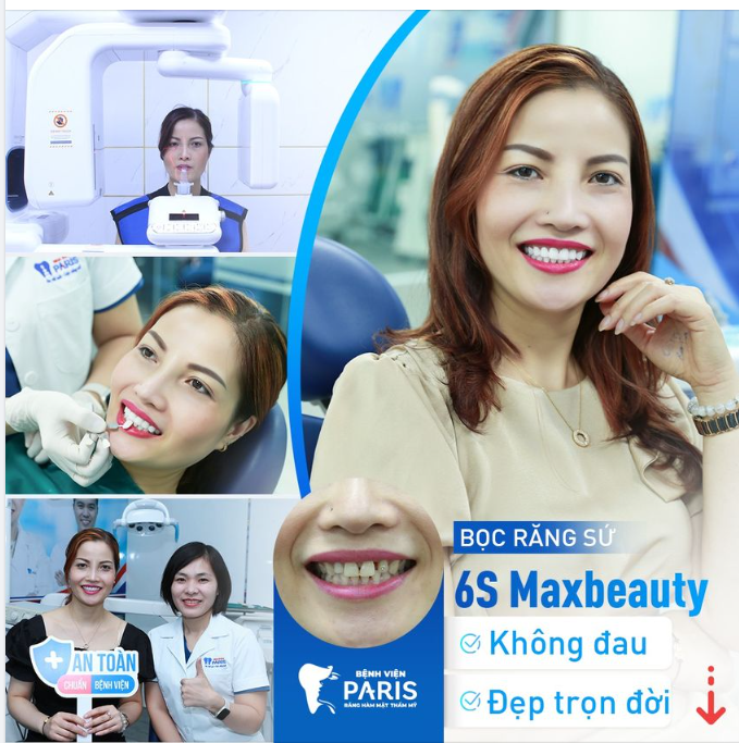 Nửa đời khổ sở răng nhiễm màu, chị Quỳnh may mắn gặp được cứu tinh của đời mình!