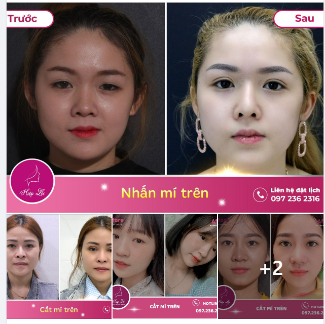 MÍ ĐẸP THẦN TỐC CHỈ SAU 45'
