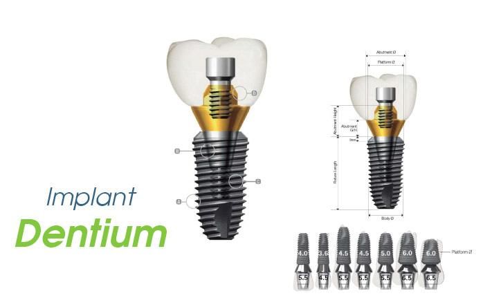 https://nhakhoathuyduc.com.vn/wp-content/uploads/2022/08/implant-dentium-my.jpg