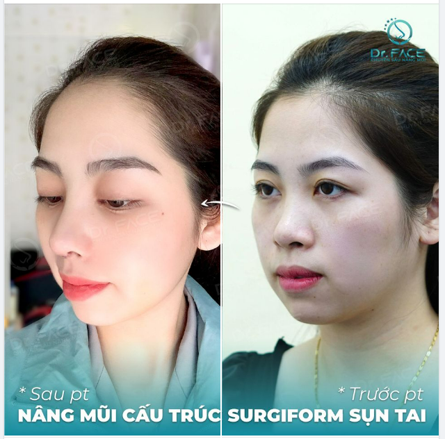 Bạn đã chuẩn bị gì cho 1 tuần vui vẻ, 1 tháng bình an, 1 năm suôn sẻ, 1 đời hạnh phúc