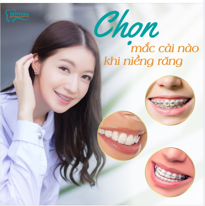 BẬT MÍ CÁC PHƯƠNG PHÁP NIỀNG RĂNG PHỔ BIẾN HIỆN NAY