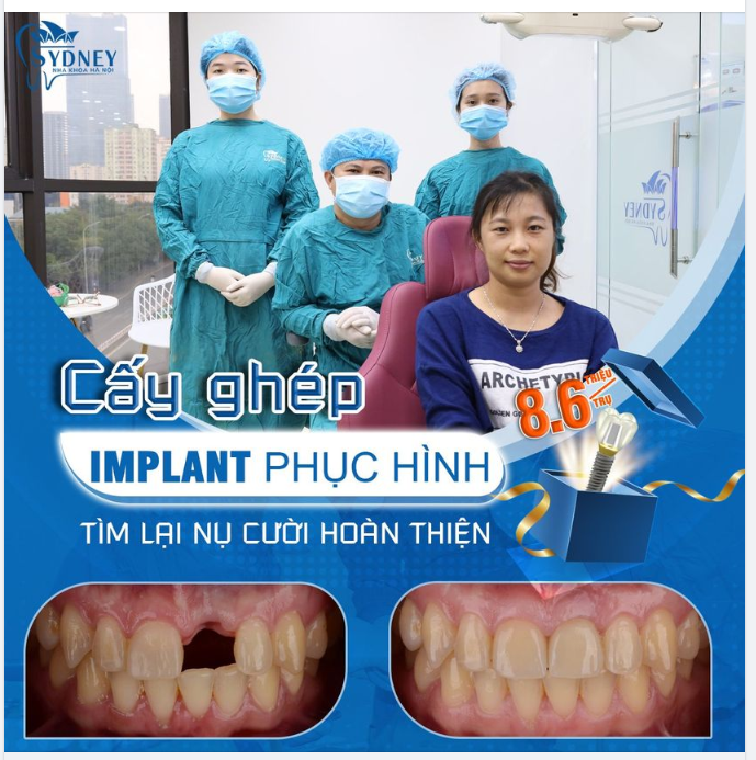 Cấy ghép Implant để nụ cười trẻ mãi