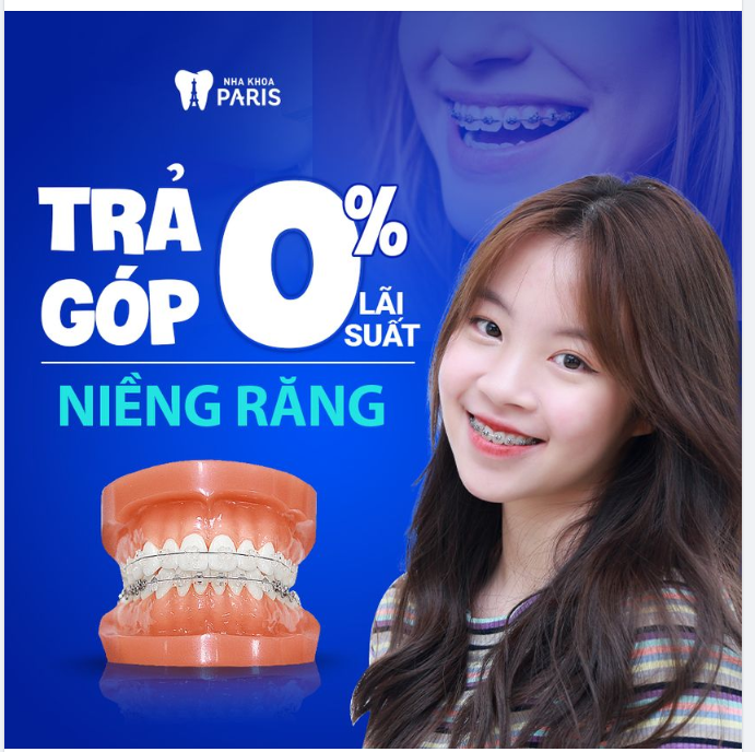 CHÍNH SÁCH NIỀNG RĂNG TRẢ GÓP TẠI NHA KHOA PARIS