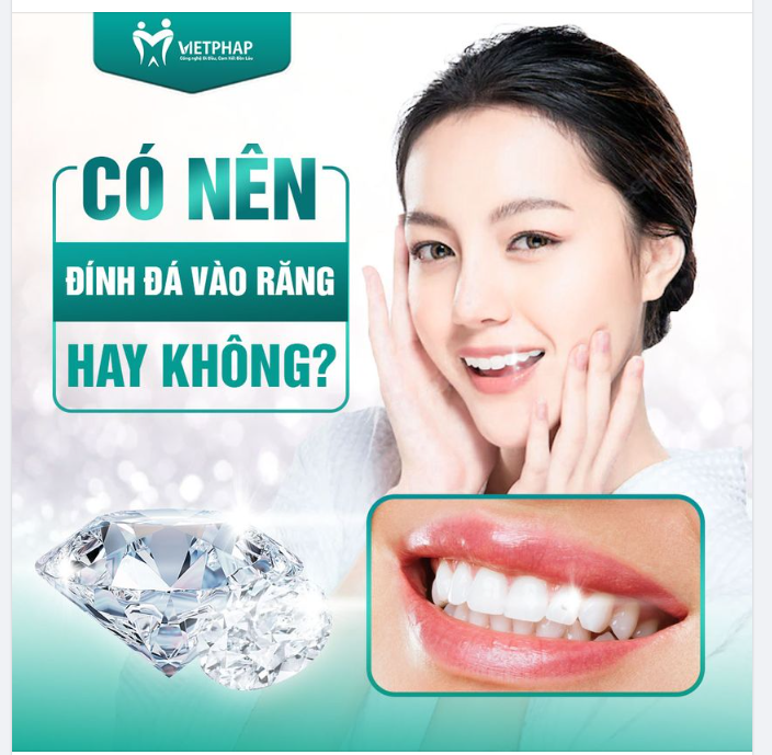 CÓ NÊN ĐÍNH ĐÁ VÀO RĂNG HAY KHÔNG?
