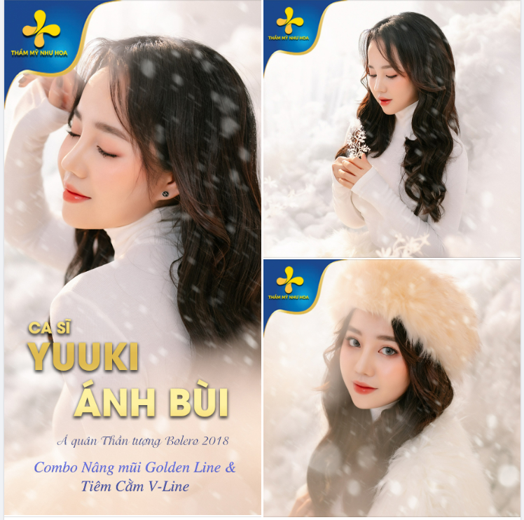 Combo NÂNG MŨI GOLDEN LINE TIÊM FILLER TẠO CẰM V-LINE cho Á quân Thần tượng Bolero 2018 - Ca sĩ Yuuki Ánh Bùi.