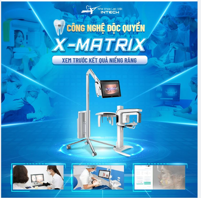 CÔNG NGHỆ ĐỘC QUYỀN X-MATRIX - XEM TRƯỚC KẾT QUẢ NIỀNG RĂNG