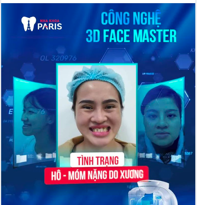 CÔNG NGHỆ PHẪU THUẬT HÀM MẶT HÀNG ĐẦU THẾ GIỚI