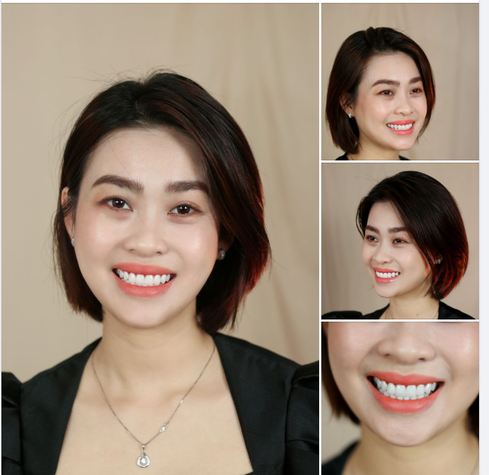 Cười đẹp như chị Quyên không khó, chỉ cần bạn đủ quyết tâm, dám thực hiện thì sẽ được đẹp như chị ấy.
