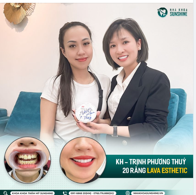 Đây là lí do khiến 10/10 khách hàng an tâm lựa chọn bọc răng sứ thẩm mỹ tại  Sunshine