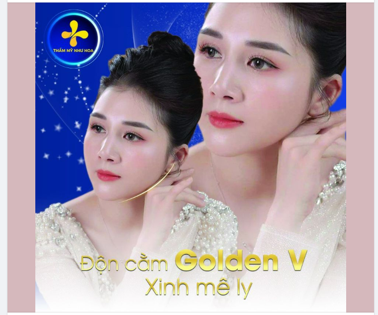 ĐỘN CẰM GOLDEN V – XINH MÊ LY