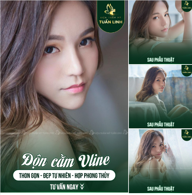 ĐỘN CẰM XINH SANG - CHUẨN TỶ LỆ VÀNG
