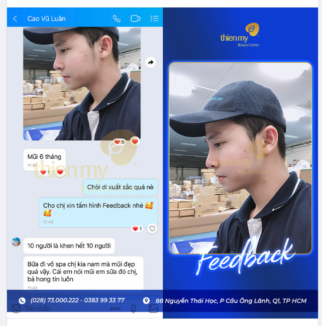 Feedback Khách Nam Nâng mũi tại Thiện Mỹ!