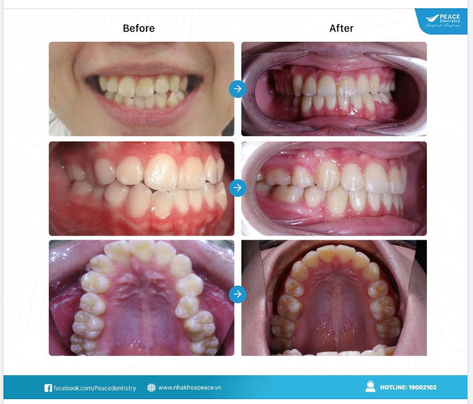 HAI NĂM ĐỂ THAY ĐỔI - TẠI SAO KHÔNG?