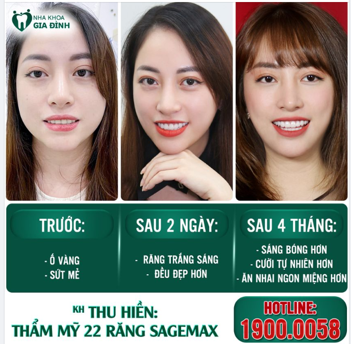 HÃY THĂM KHÁM RĂNG ĐỊNH KỲ, ĐÓ LÀ CÁCH BẠN BẢO VỆ RĂNG SỨ️