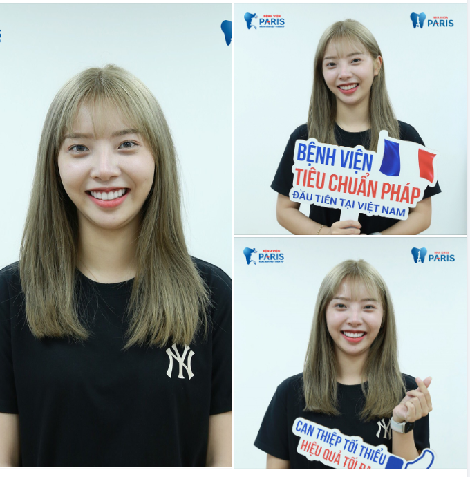 INVISALIGN + DÁN SỨ VENEER​​​​​​​ XU HƯỚNG THẨM MỸ MỚI ĐƯỢC GIỚI TRẺ ƯA CHUỘNG