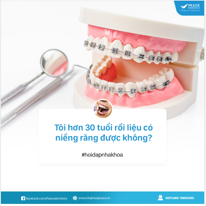 KHÔNG BAO GIỜ QUÁ TUỔI ĐỂ NIỀNG RĂNG!