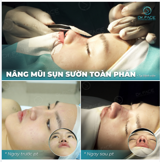 KHÔNG ĐẸP VÌ…QUÁ ĐẸP!