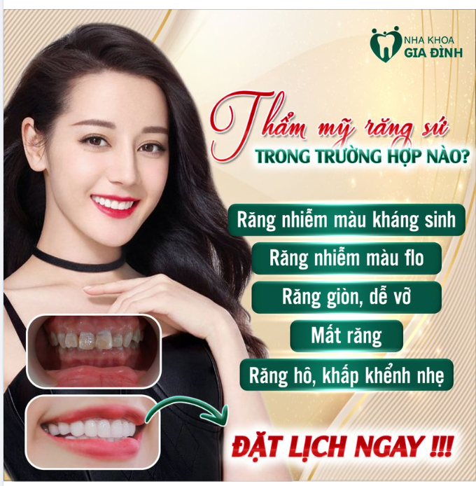KHÔNG PHẢI TRƯỜNG HỢP NÀO BÁC SĨ NKGĐ CŨNG KHUYÊN LÀM RĂNG SỨ THẨM MỸ