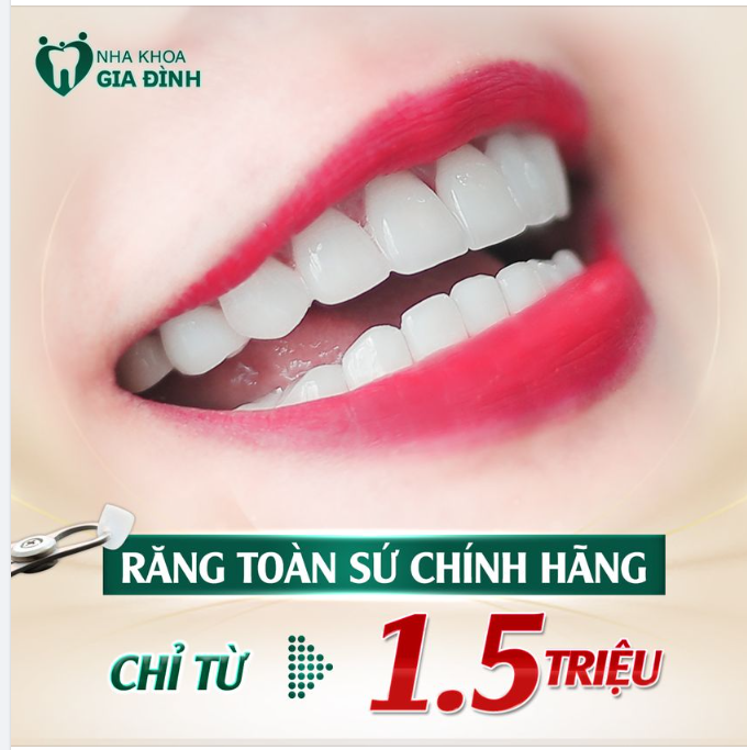 LÀM RĂNG CỰC XINH - CHẠM ĐỈNH NHAN SẮC