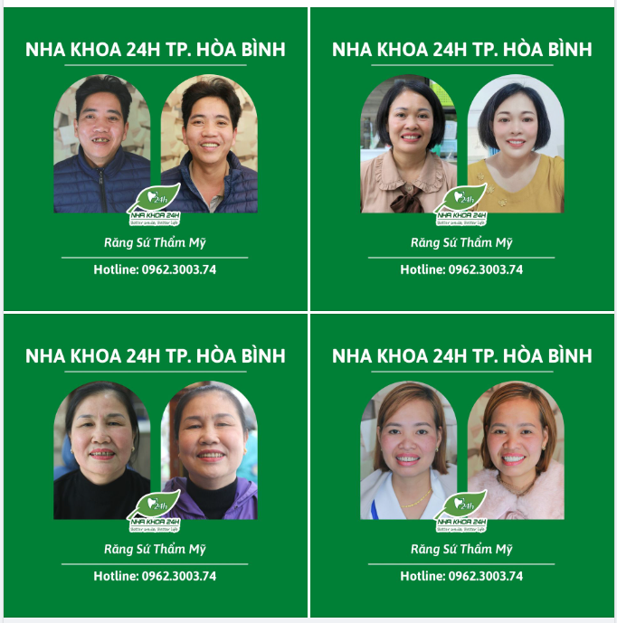 LÀM THẨM MỸ RĂNG SỨ - GIÚP CUỘC SỐNG TƯƠI ĐẸP HƠN