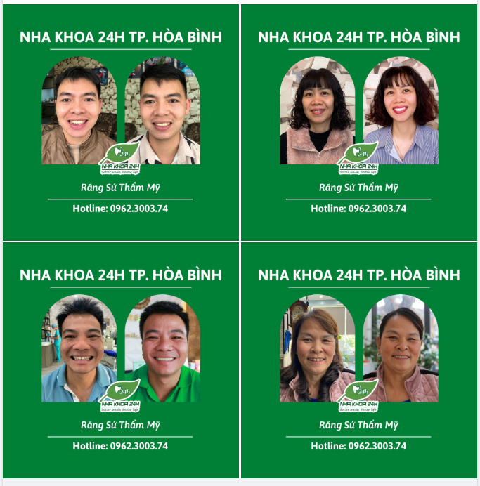 LÀM THẨM MỸ RĂNG SỨ - GIÚP CUỘC SỐNG TƯƠI ĐẸP HƠN