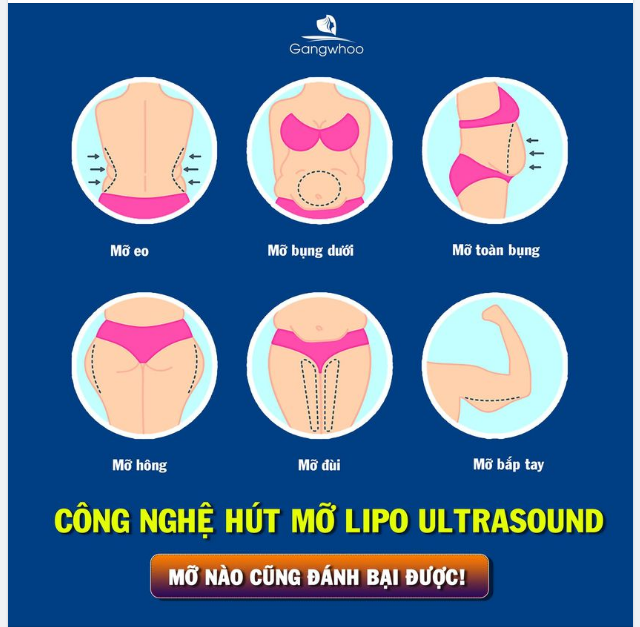 LIPO ULTRASOUND - MỠ NÀO CŨNG ĐÁNH BẠI ĐƯỢC