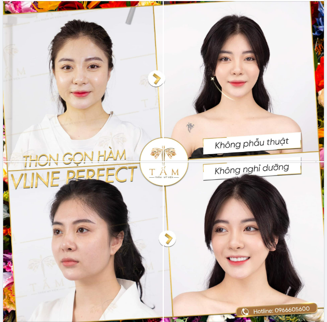 MẶT TO BẠNH KÉM SẮC - VỚI LIỆU TRÌNH CHỈ 45P LÀ HẾT