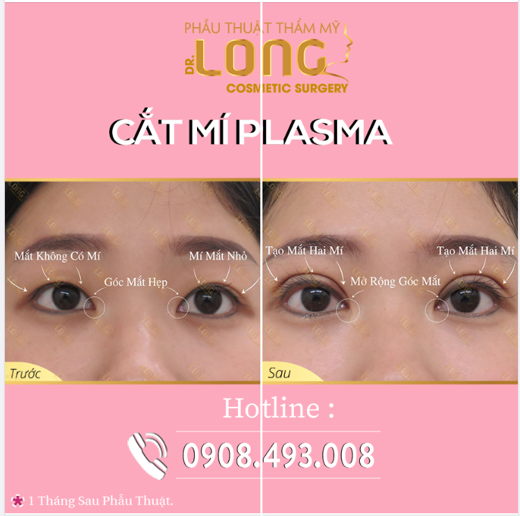 Mí đẹp mắt xinh- lung linh tỏa sáng