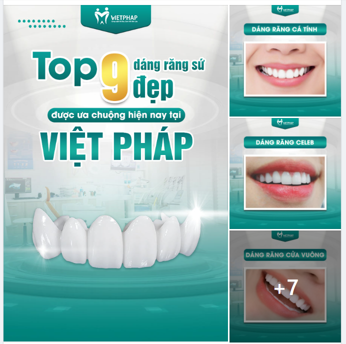 MUA XĂNG THÌ KHÓ CHỨ “MUA” NỤ CƯỜI ĐẸP TỪ VIỆT PHÁP THÌ THA HỒ
