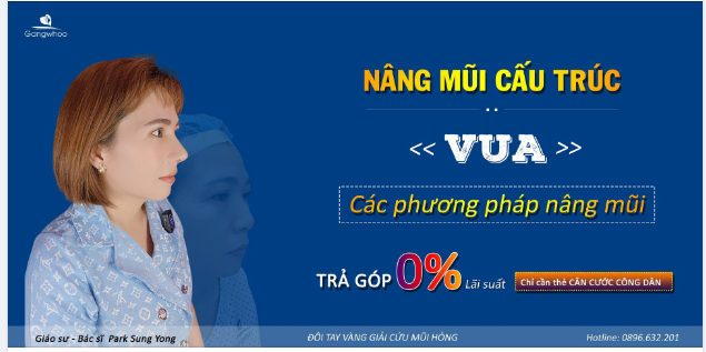 NÂNG MŨI CẤU TRÚC - VUA CÁC PHƯƠNG PHÁP NÂNG MŨI
