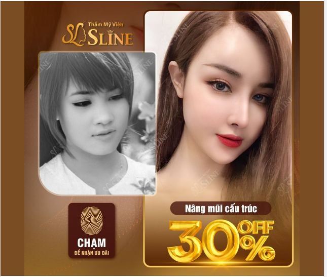 NÂNG MŨI CẤU TRÚC.