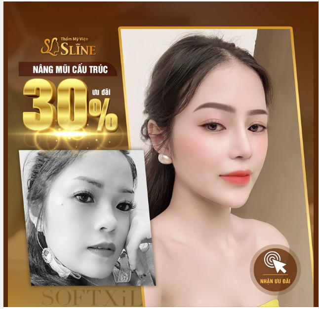 NÂNG MŨI CẤU TRÚC.