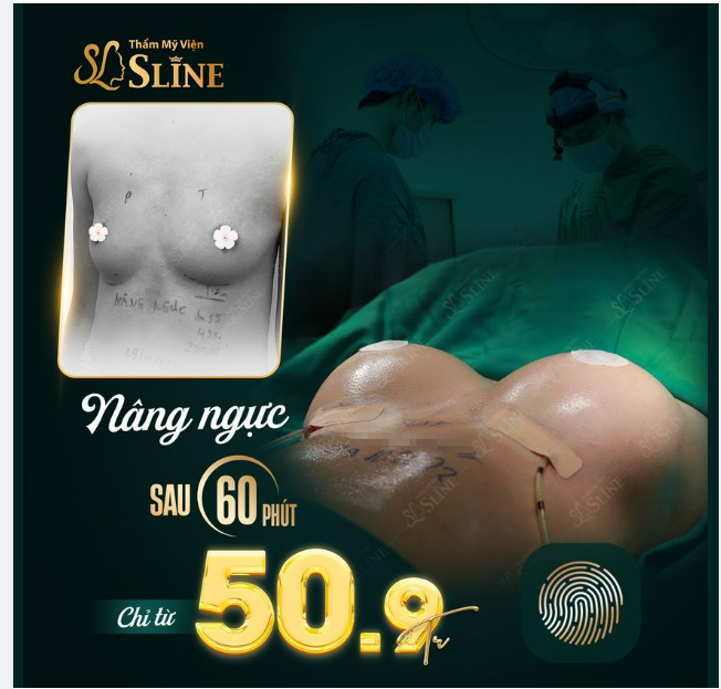 Nâng ngực trọn gói 50,9tr